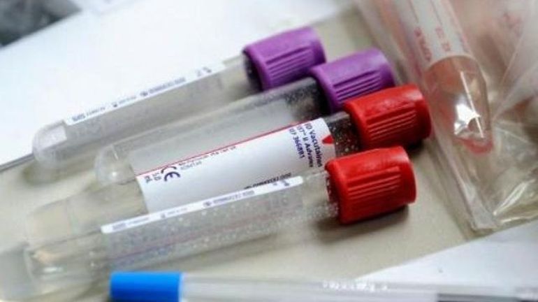 Les laboratoires tentent d'augmenter leur efficacité