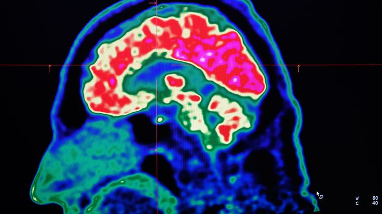 Une découverte belge : de petits organismes régulent le développement de notre cerveau