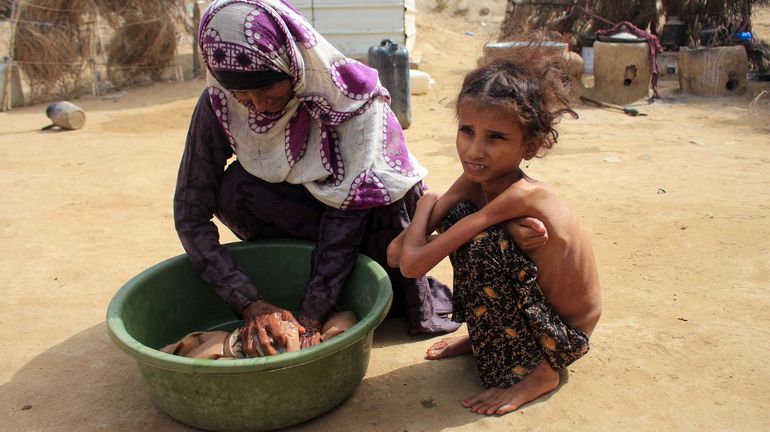 Selon l'ONU, la moitié des enfants du Yémen vont souffrir de malnutrition en 2021
