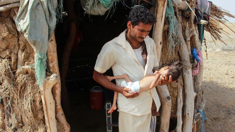 Conflit au Yémen : 3,2 millions de personnes devraient souffrir d'insécurité alimentaire, une augmentation de 60%