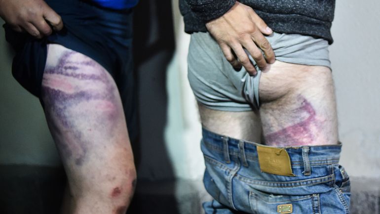 Biélorussie: les protestataires libérés racontent les tortures en prison