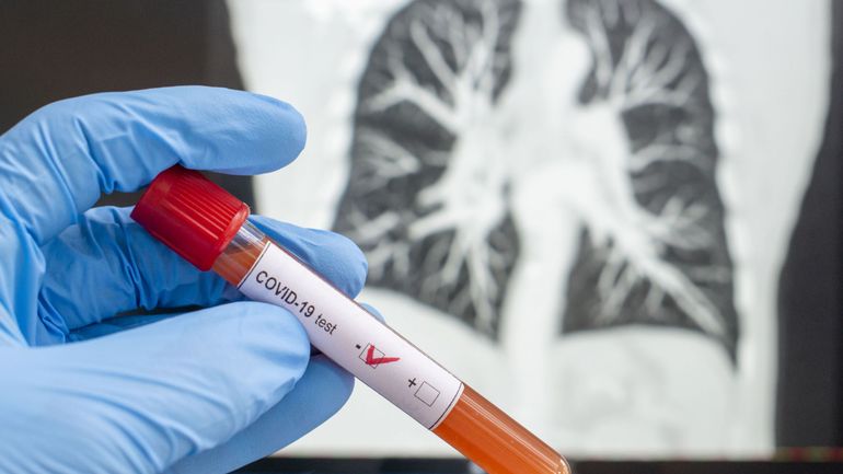 Coronavirus en Belgique : « Nous avons les capacités de testing », et si on s'en servait ?