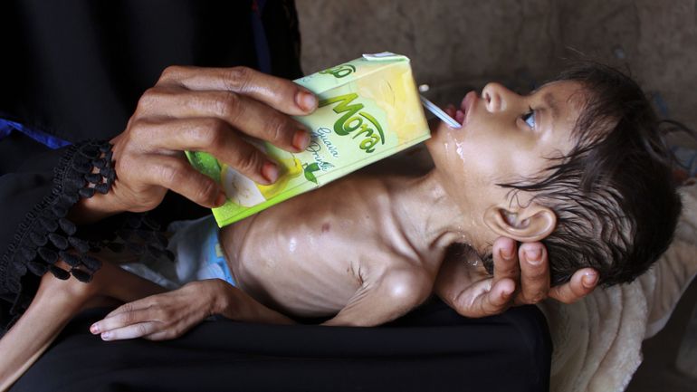 Famine au Yémen : une 