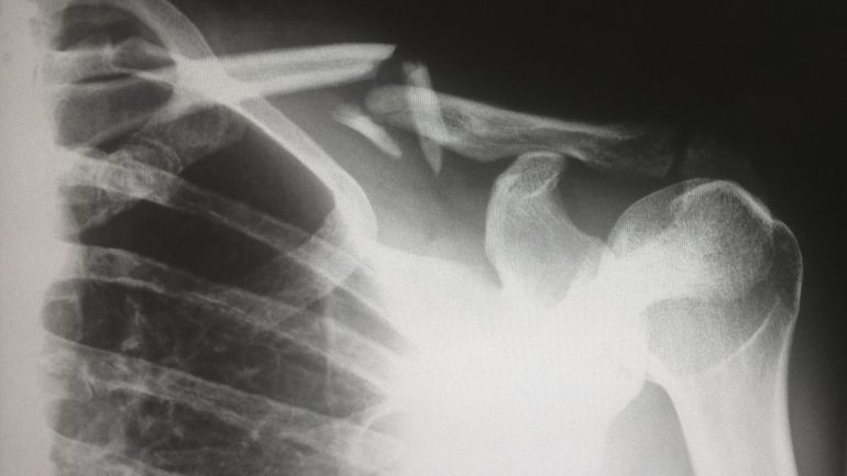 Plus d'un milliard d'images médicales accessibles sur internet, faute de protection suffisante
