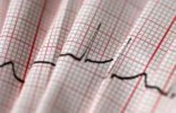 Les troubles du rythme cardiaque: un cardiologue vous répond dès
11h30