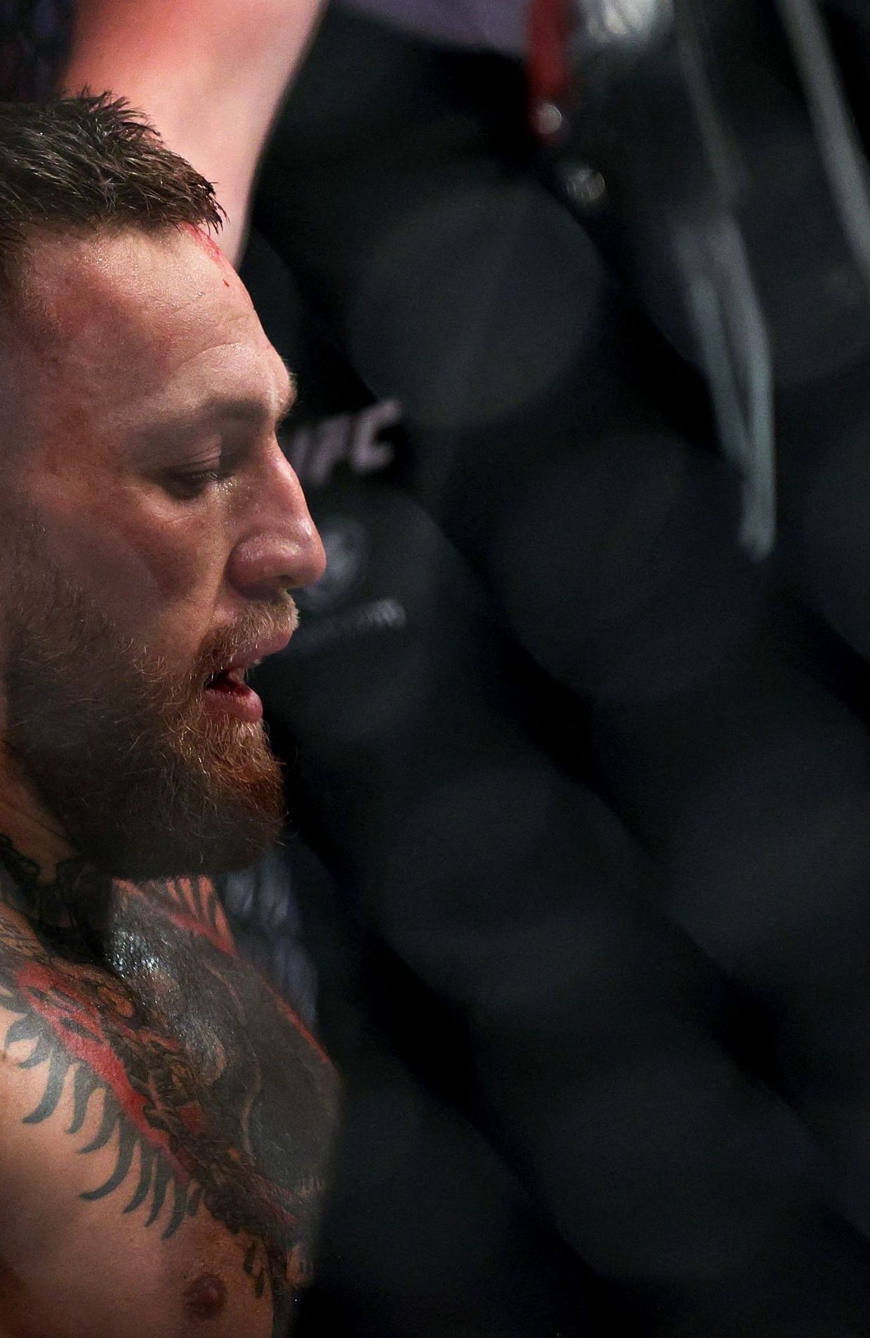 Fracture de la cheville pour Conor McGregor qui abandonne Dustin