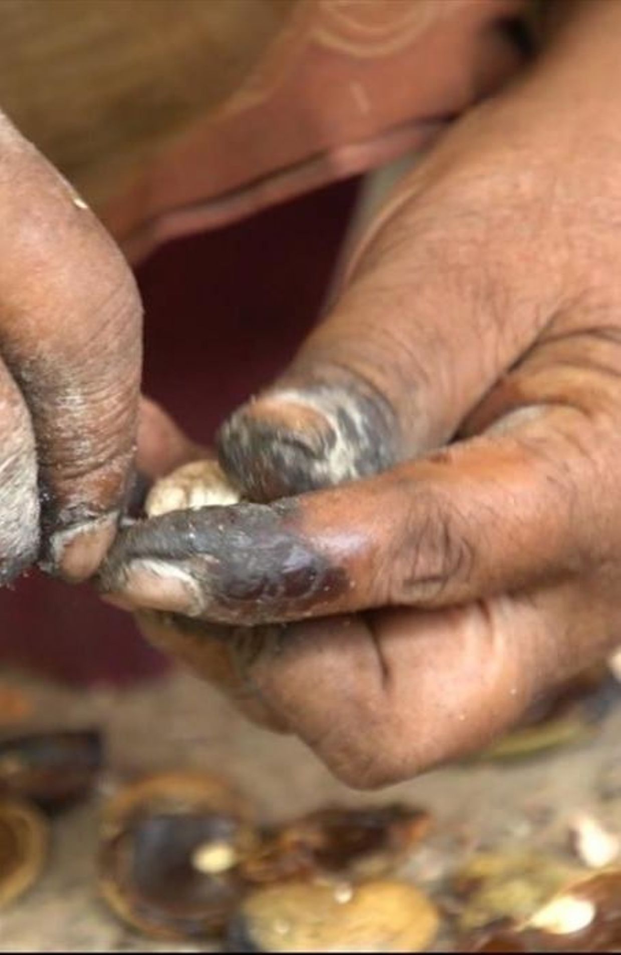 La cueillette de noix de cajou, toxique pour les mains