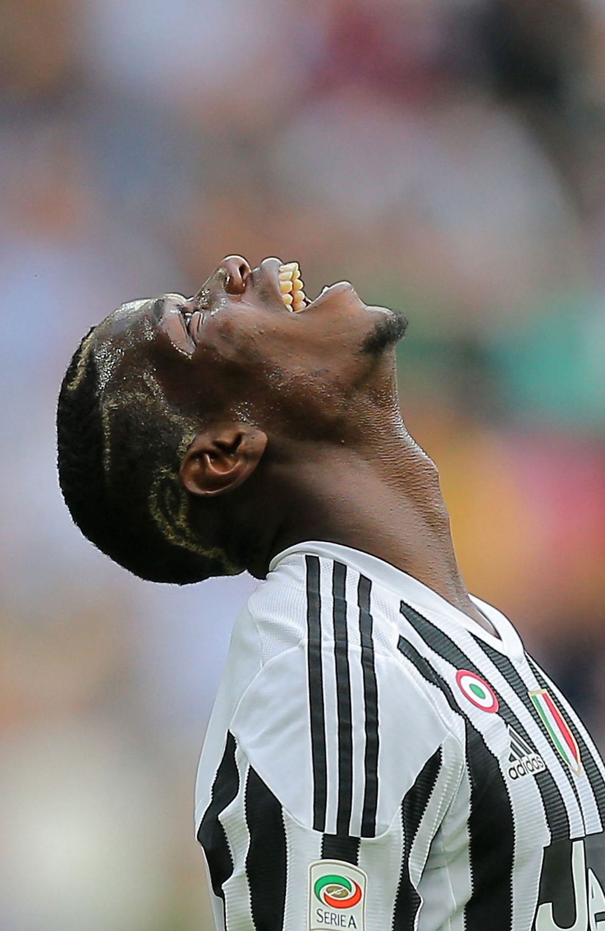Paul Pogba déjà blessé avec la Juventus.