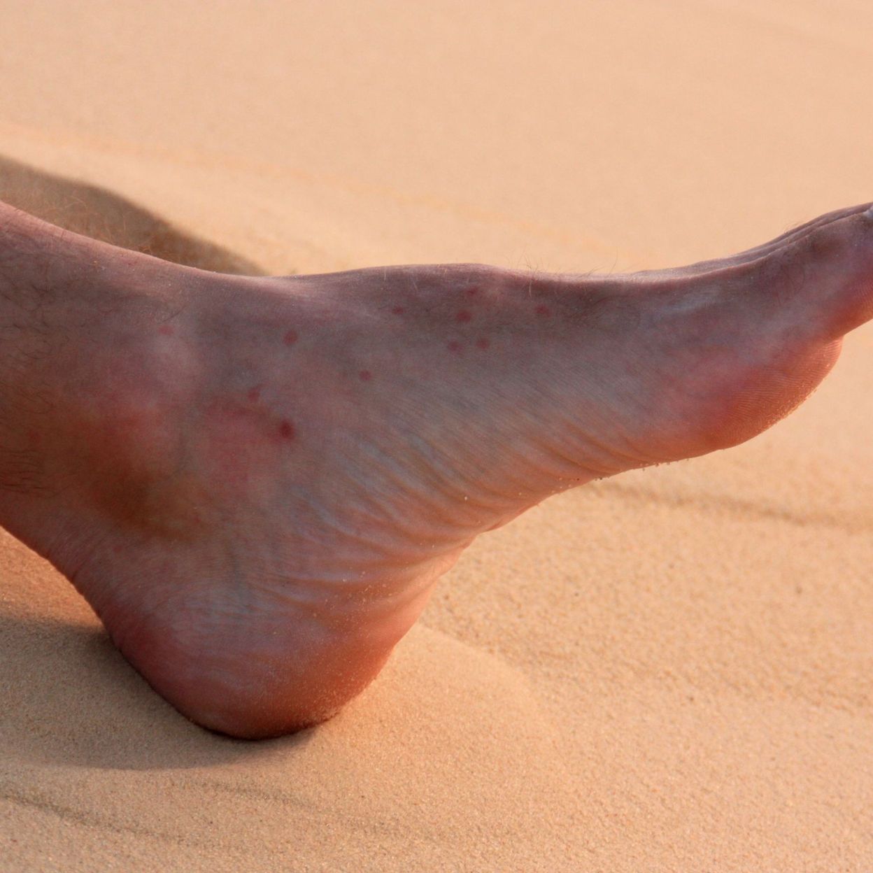 La puce de sable comment viter ce petit crustac capable de