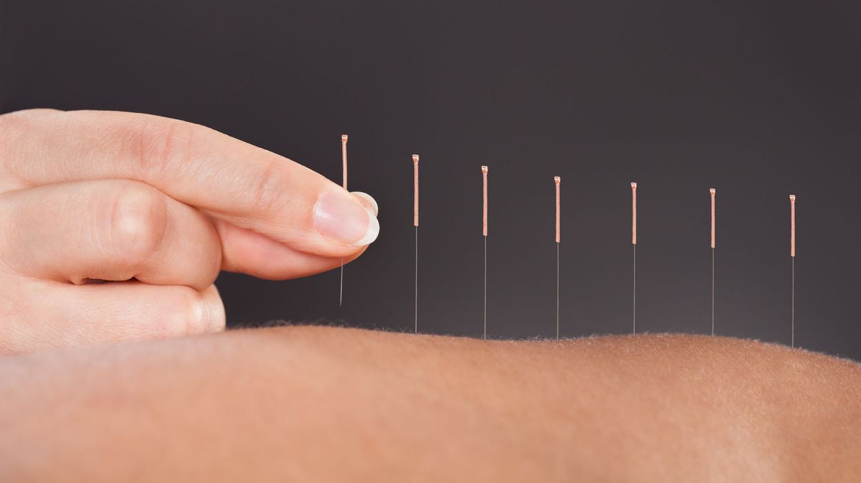 Cancer du sein l'acupuncture réduit les douleurs liés aux effets — free download