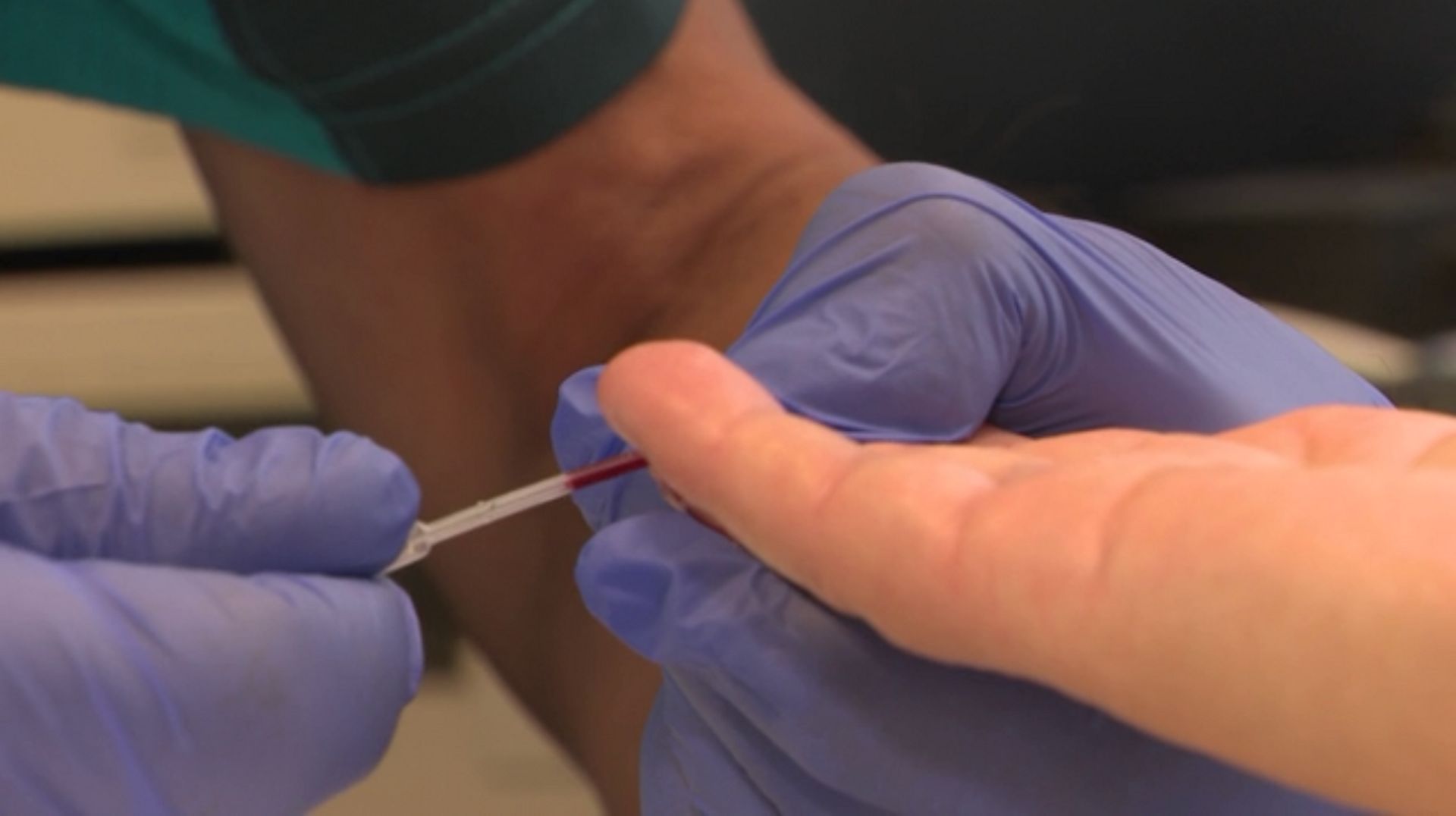 Le test de dépistage rapide se fait par le prélèvement d'un goutte de sang sur le doigt.