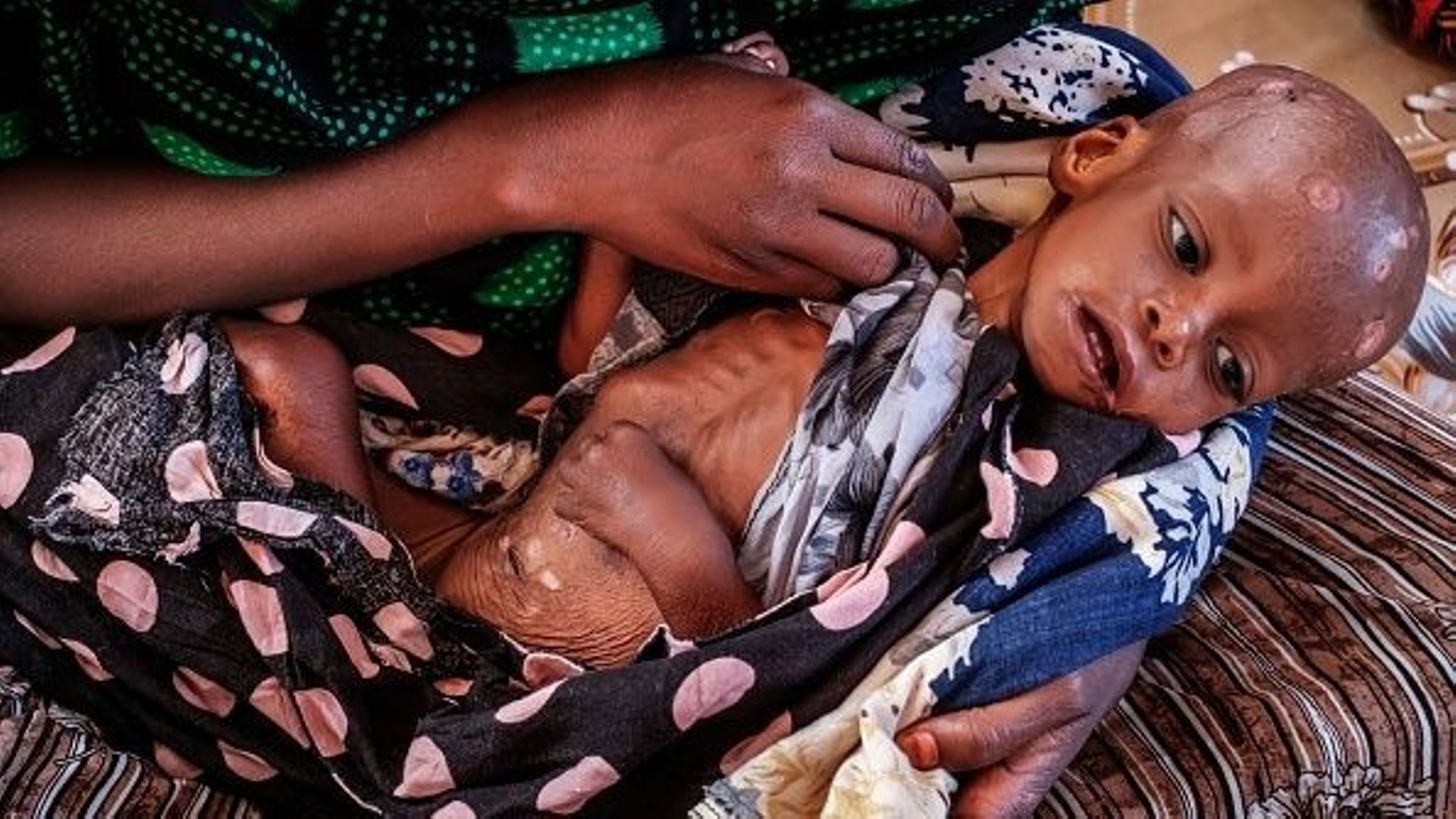 Une femme tient un enfant souffrant de malnutrition dans l’unité de nutrition de l’hôpital général de Gode, dans la ville de Gode, en Éthiopie, le 13 janvier 2023.