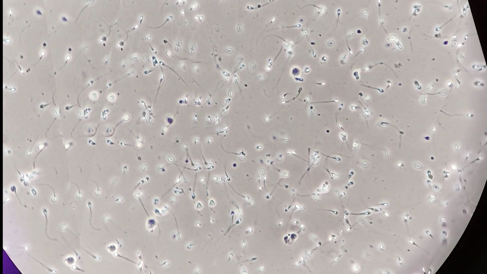 Des spermatozoïdes observés aux microscopes.