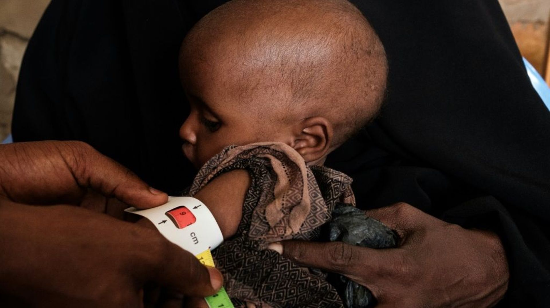 Un bébé somalien de 10 mois est examiné pour évaluer son degré de malnutrition dans un centre médical spécialisé à Baidoa, en Somalie, le 9 novembre 2022