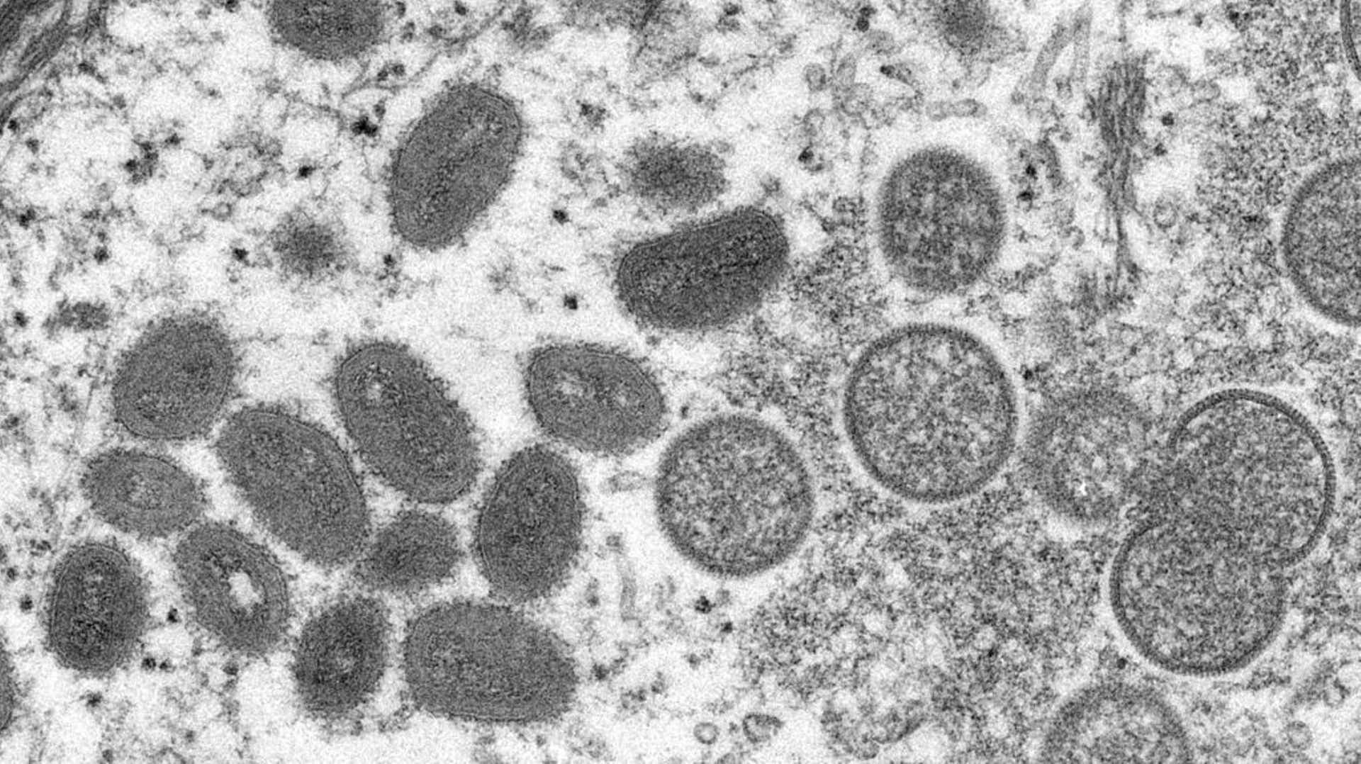 Image au microscope électronique d’un virion de variole du singe, obtenu d’un échantillon clinique pendant une épidémie chez des chiens de prairie en 2003.