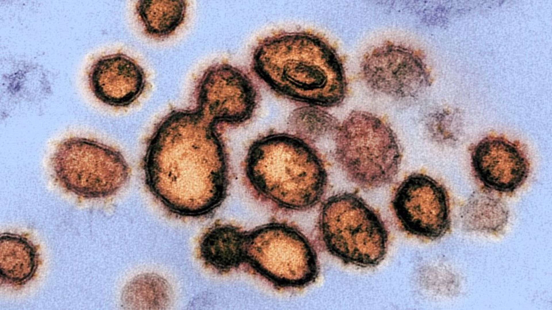 Une image du SARS-CoV-2, le virus qui cause le COVID-19