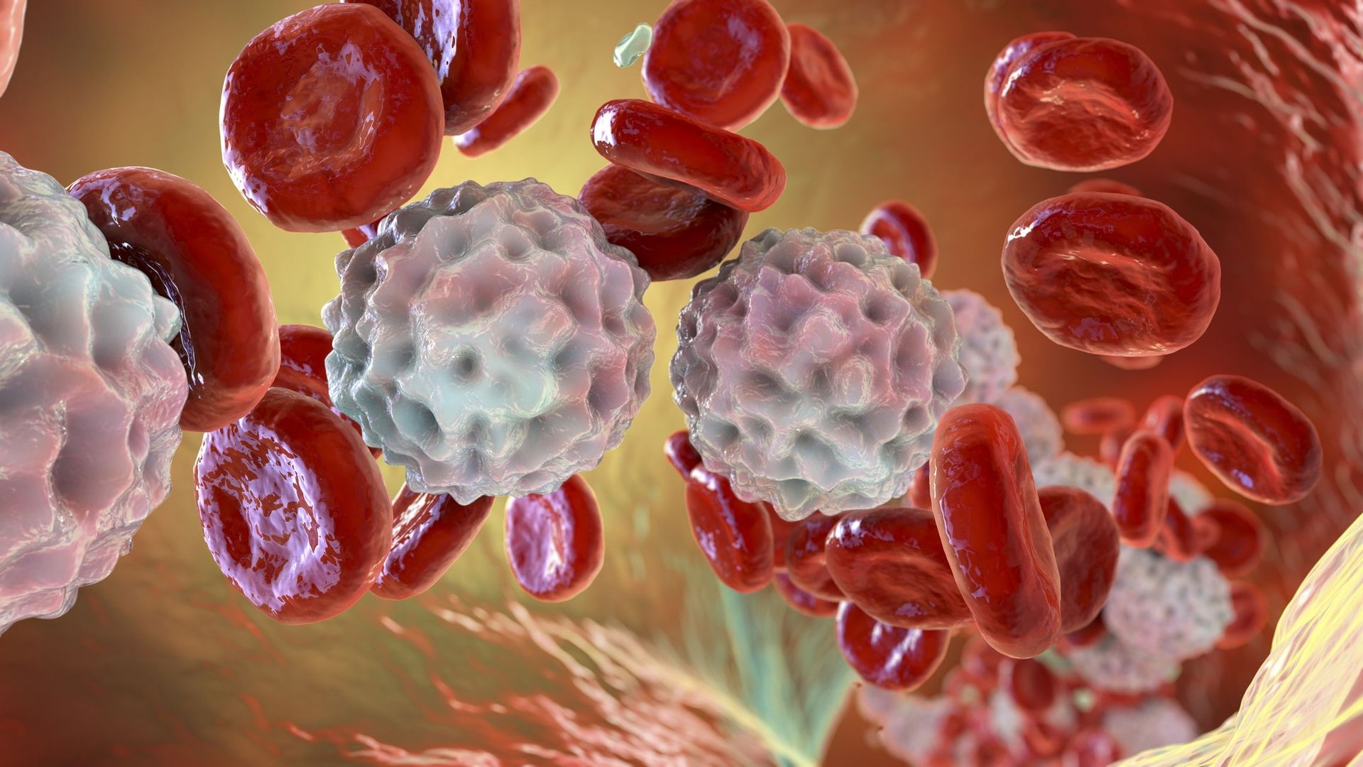 Illustration de la lymphocytose, montrant des globules blancs abondants à l’intérieur d’un vaisseau sanguin.
