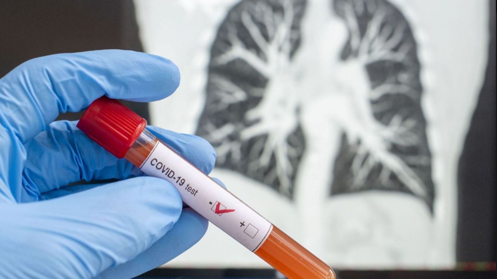 Coronavirus - La Région bruxelloise veut doubler la capacité de tests d'ici septembre - A. Maron
