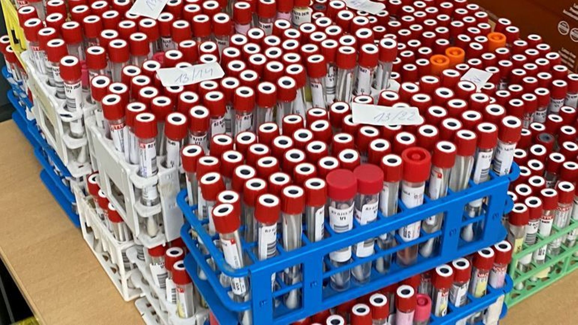 Les laboratoires Luc Olivier voudraient déprioriser l’analyse de certains tests PCR
