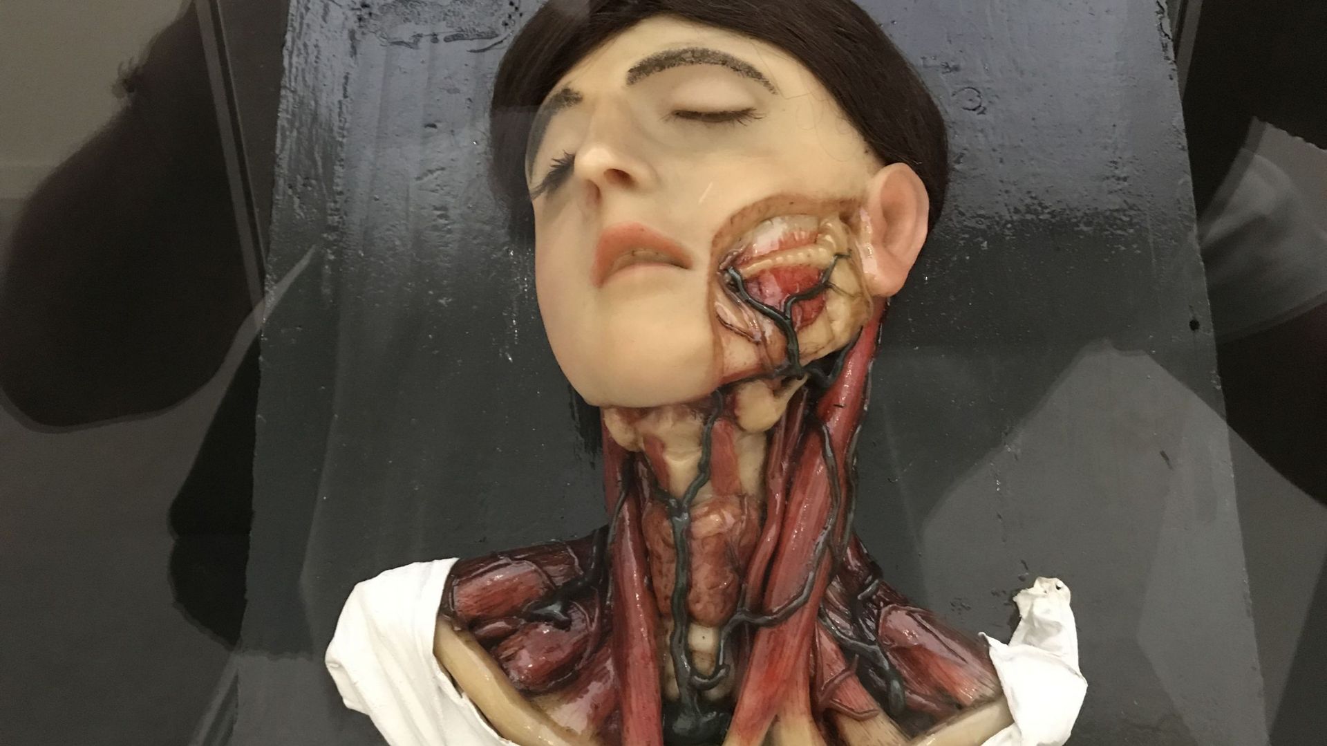 Une leçon d'anatomie où l'Art de la médecine s'expose au musée La Boverie de Liège