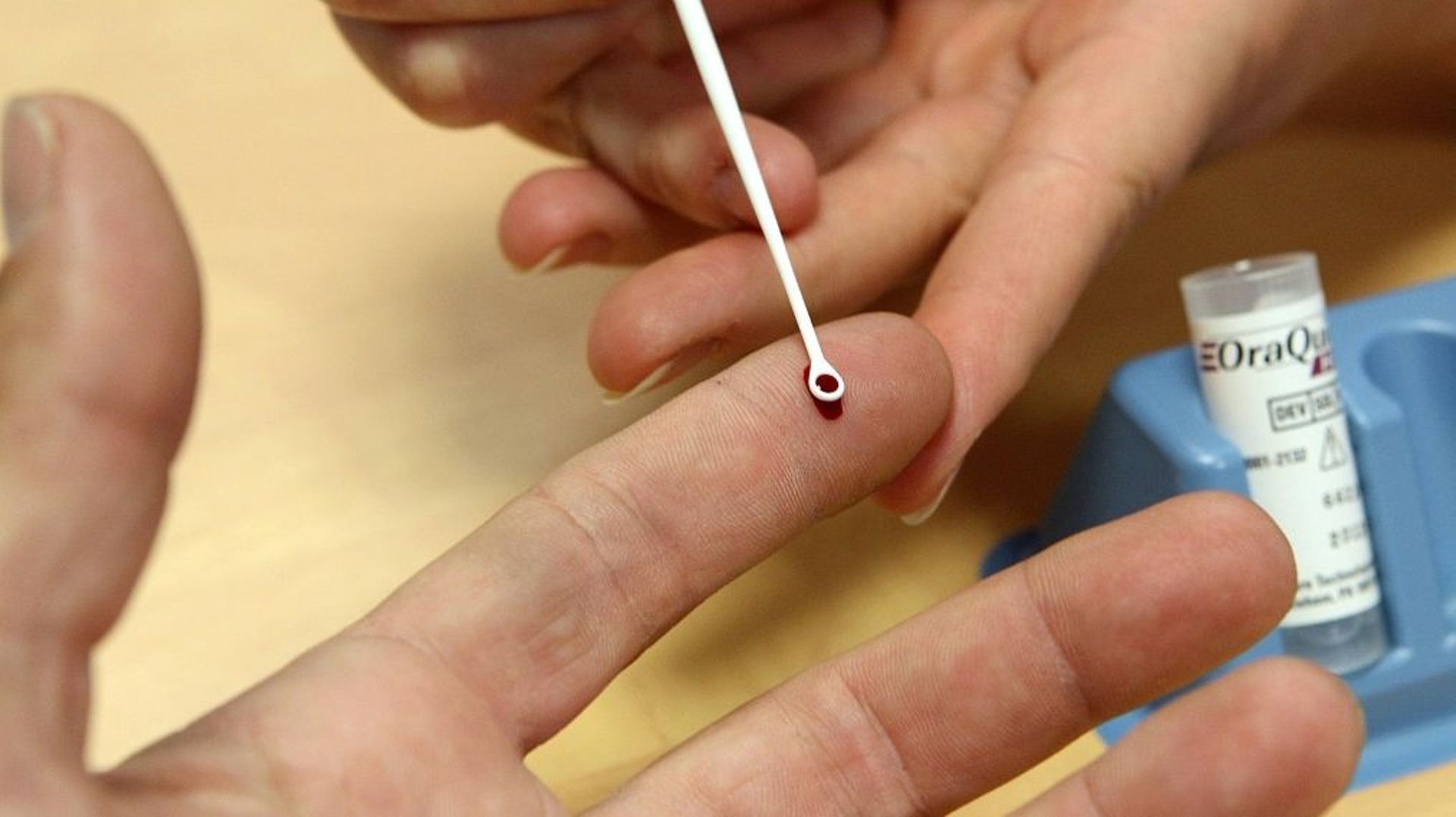 Un test sanguin prometteur pour détecter le cancer de façon précoce ...