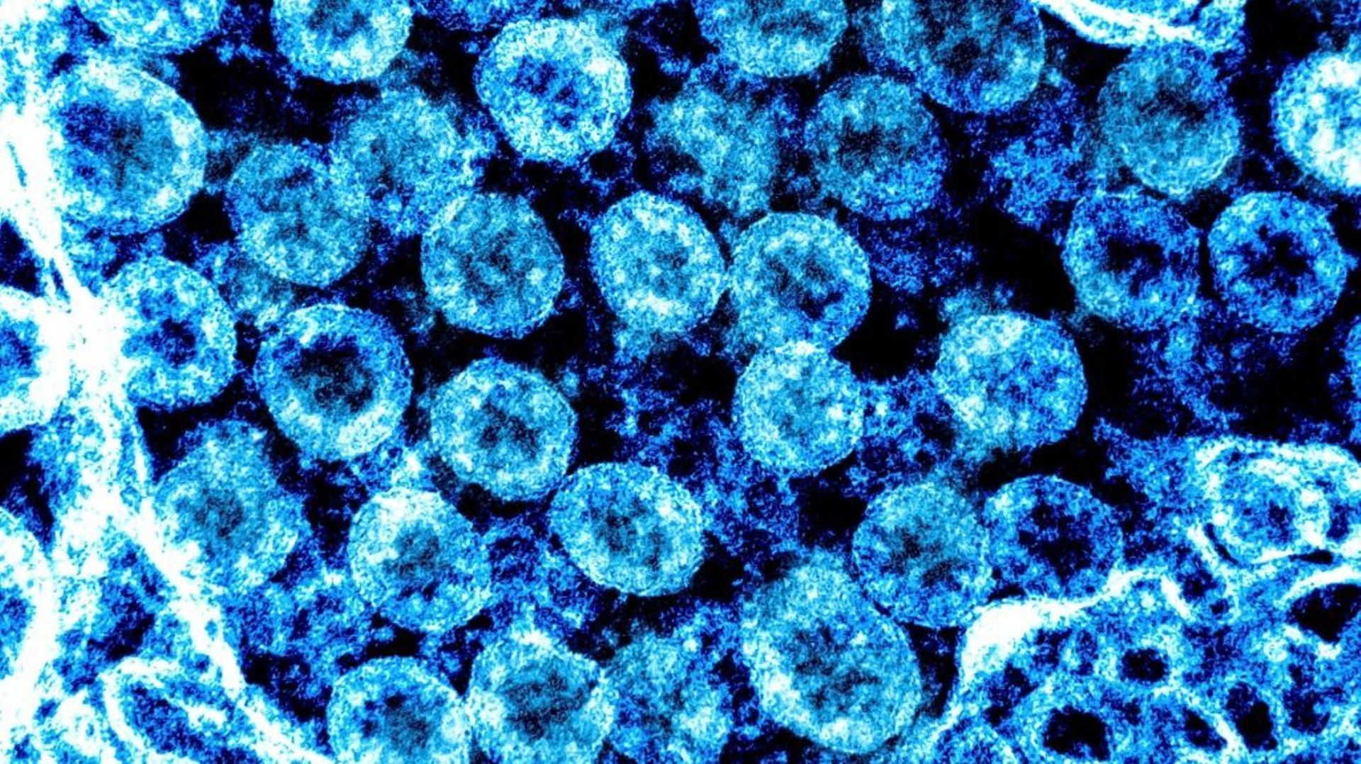 Image non-datée du virus SARS-CoV2, obtenue le 1er août 2021 