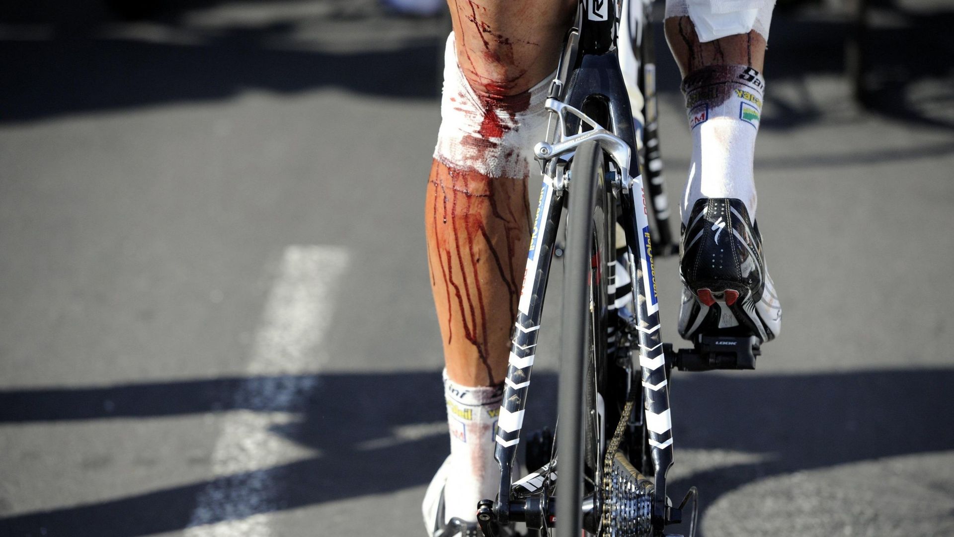 Les jambes en sang de Johnny Hoogerland après sa terrible chute dans les barbelés lors de la 9ème étape du Tour de France 2011.