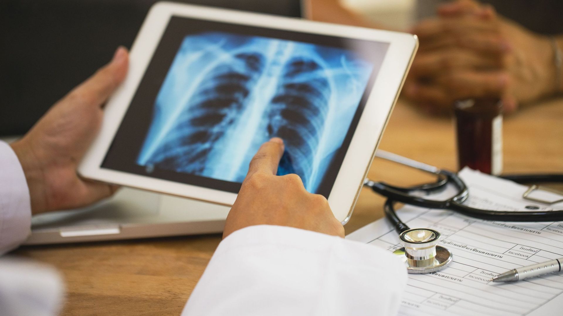 Le cancer du poumon est la principale cause des décès prématurés en Belgique