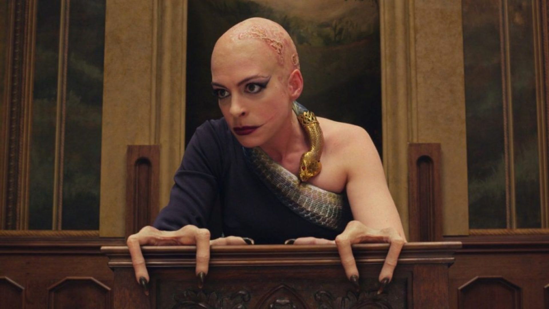 Anne Hathaway représentée avec des mains qui ressemblent fortement à celles de personnes souffrant d'ectrodactylie. 