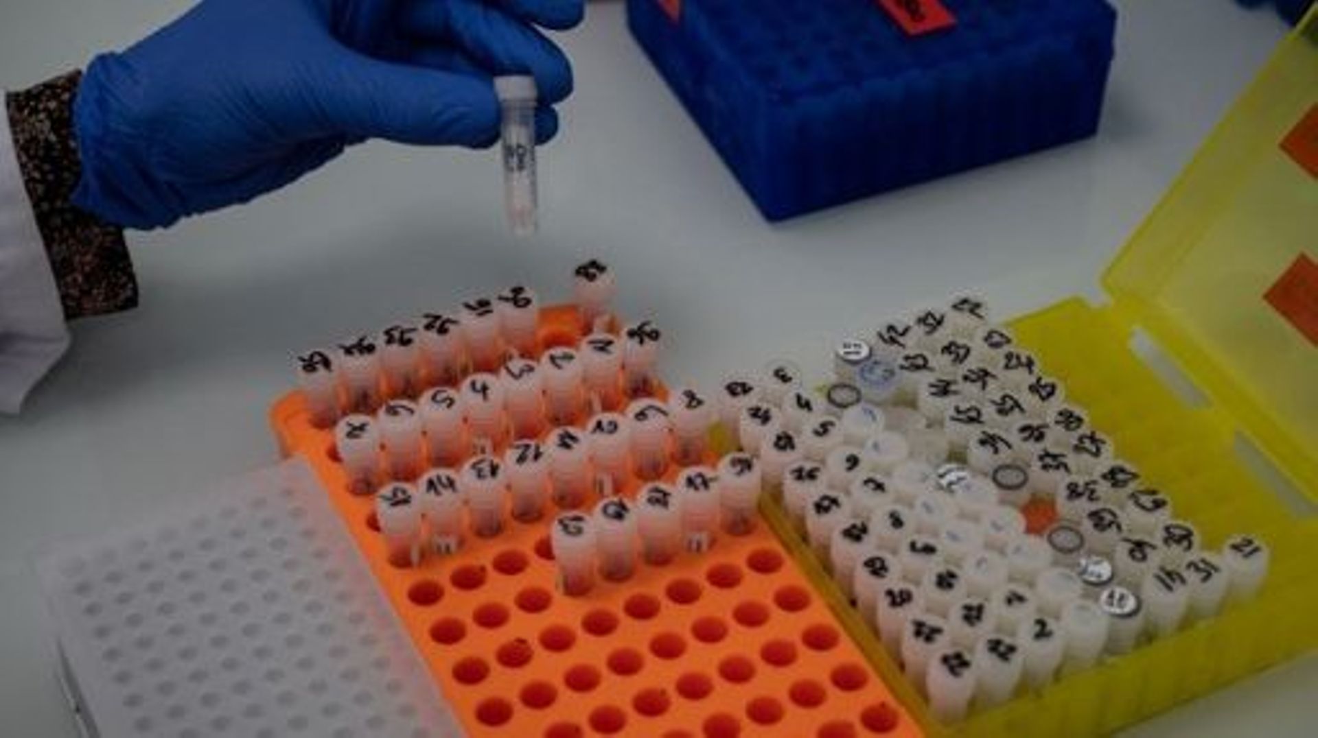 Des chercheurs du laboratoire Auragen préparent le séquençage de génomes humains pour mieux identifier les maladies rares, à Lyon, dans le centre-est de la France, le 23 février 2022. Près de 8000 maladies rares ont été identifiées à ce jour et elles touc