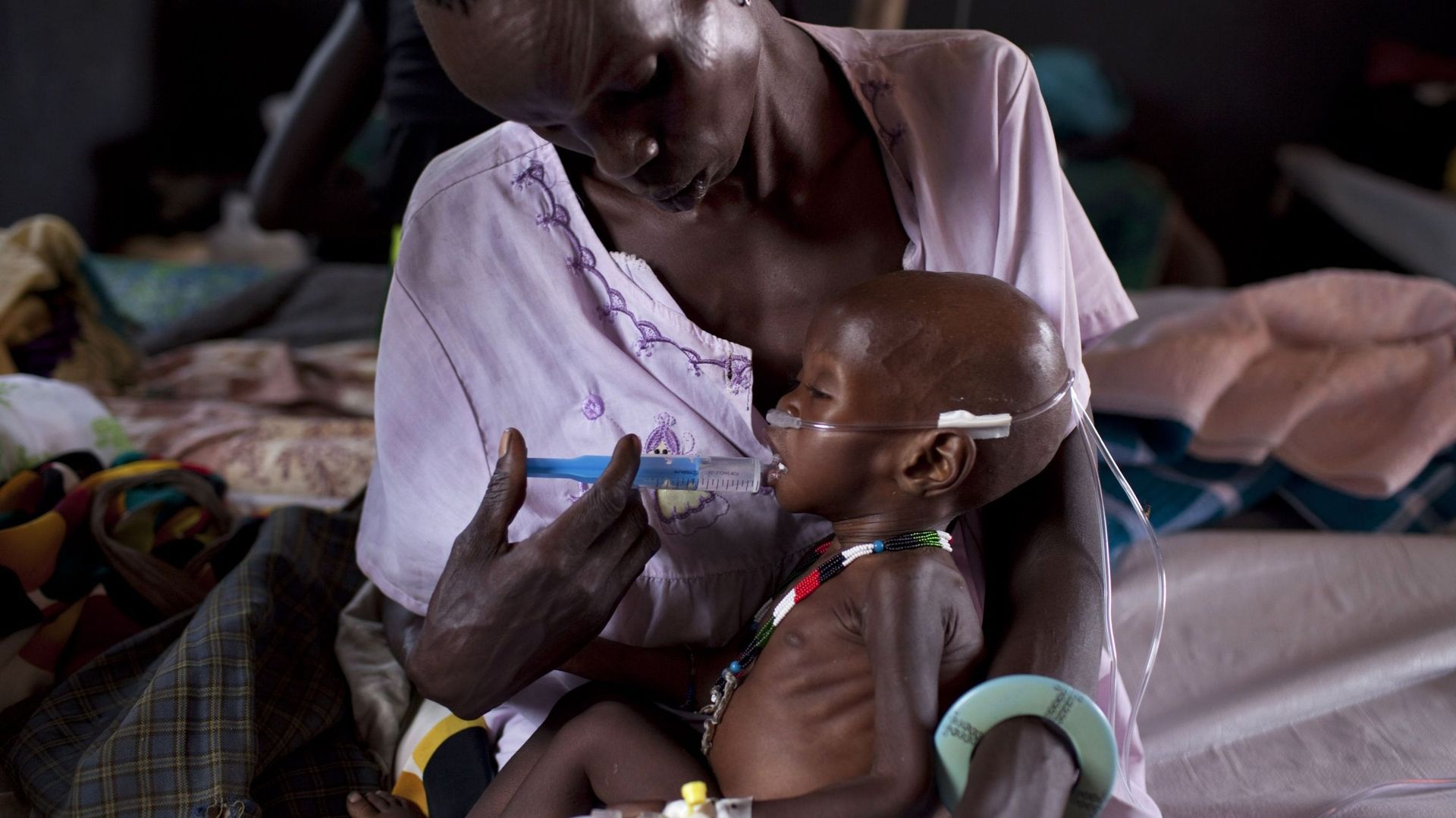 Un enfant souffrant de malnutrition