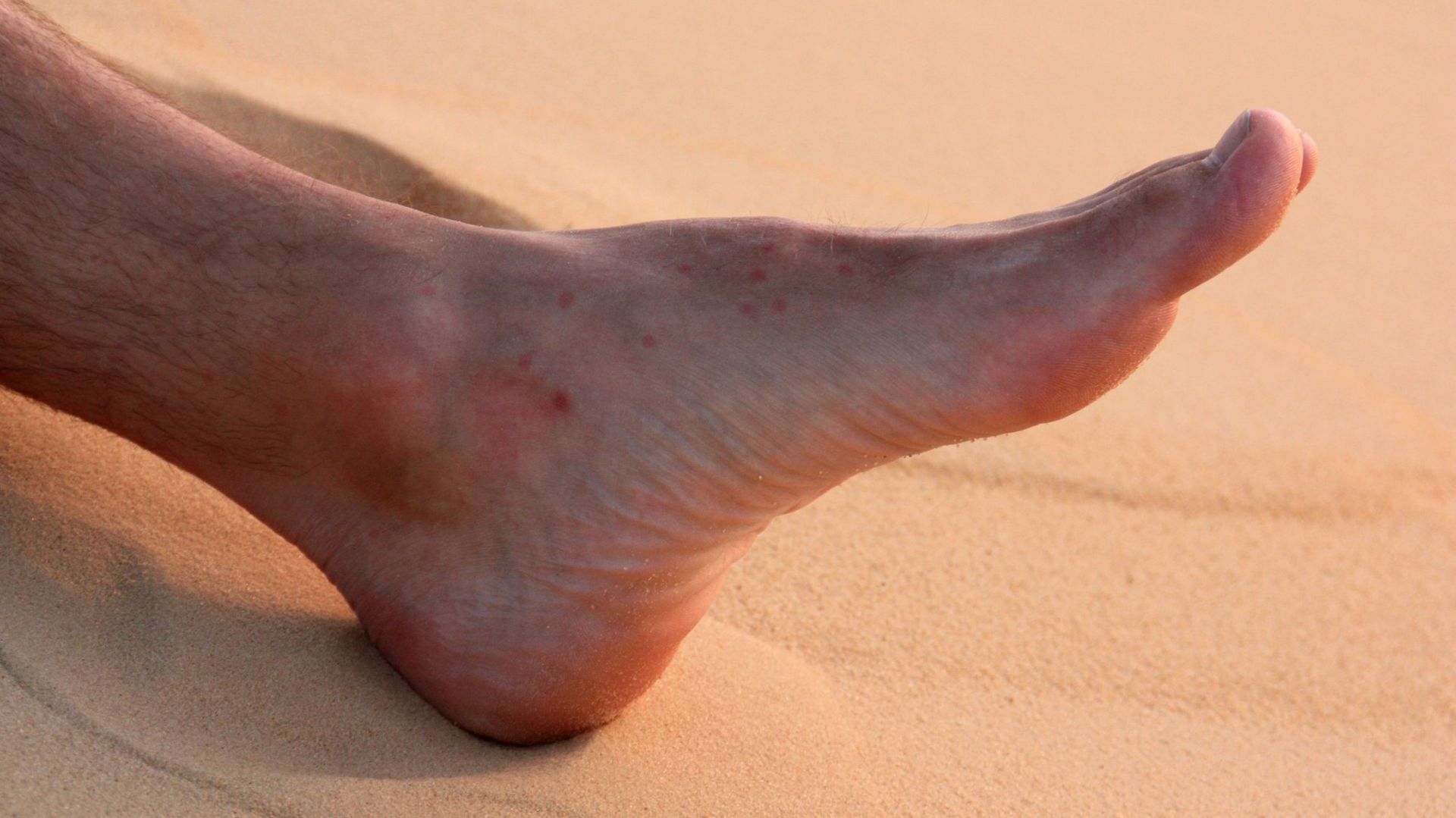La puce de sable : un petit crustacé capable de gâcher vos vacances à la plage !