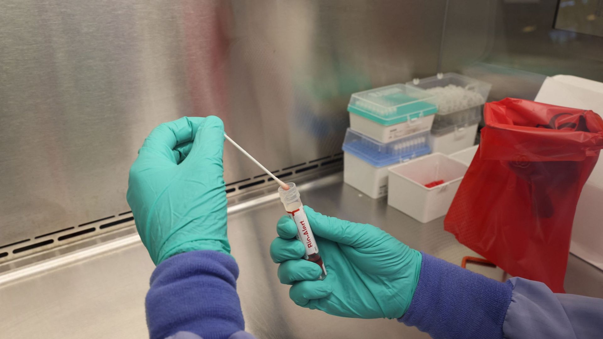 UW Medicine Virology Lab Tests For Monkeypox Virus