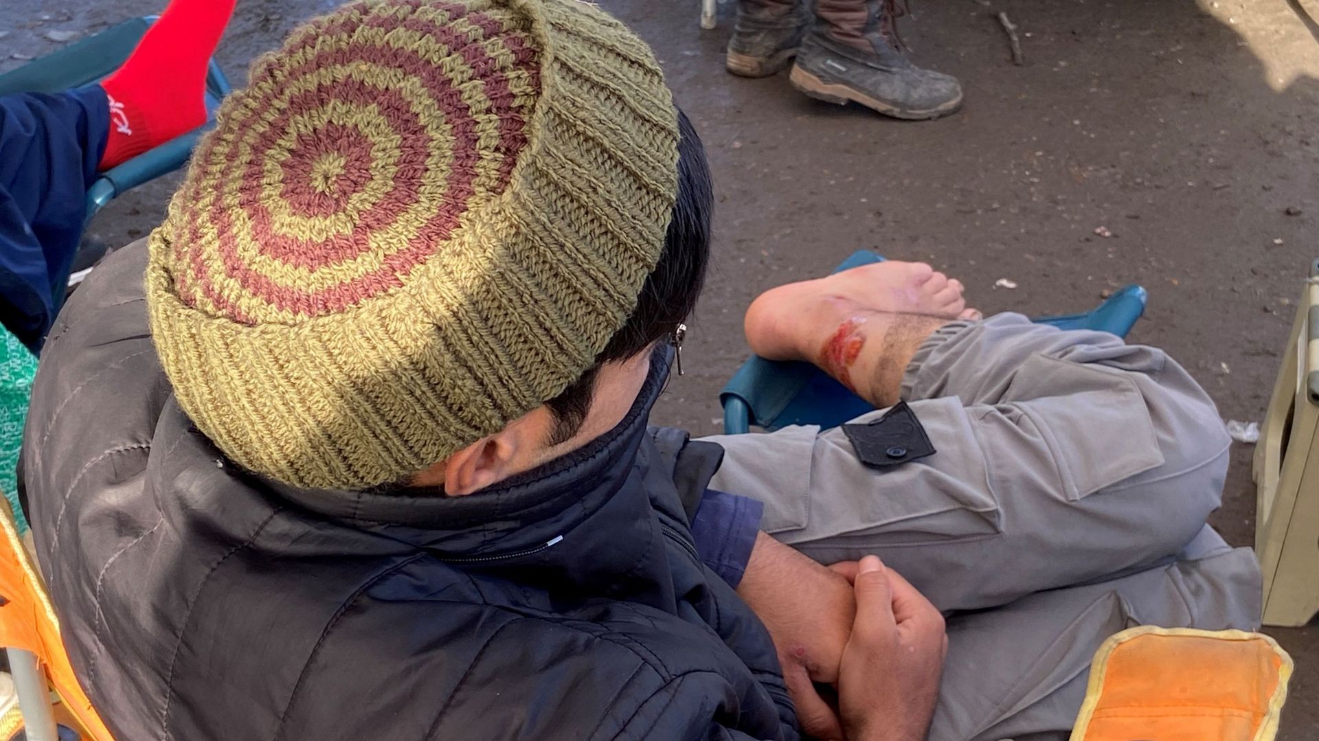 De nombreuses blessures aux pieds