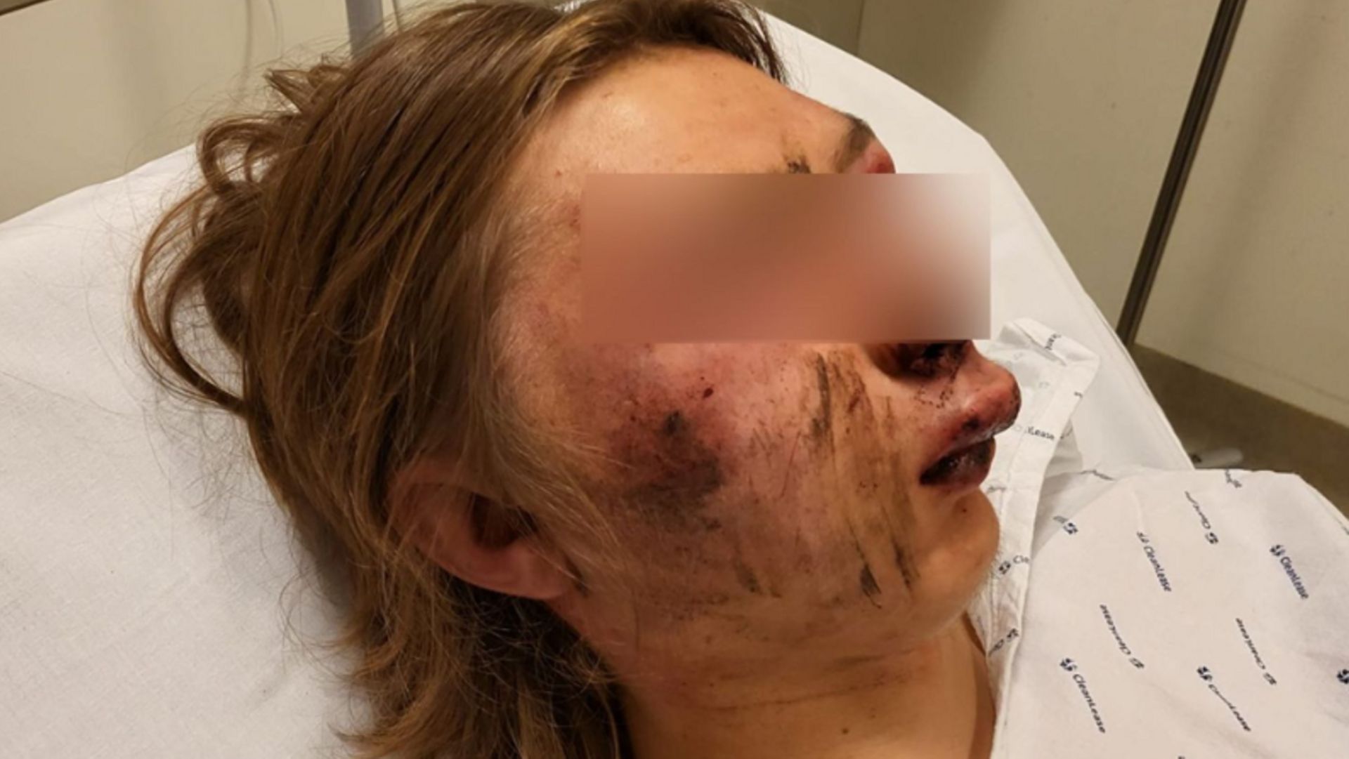 Un jeune de quinze ans tabassé à Namur : le parquet requiert jusqu’à dix ans de prison contre les agresseurs