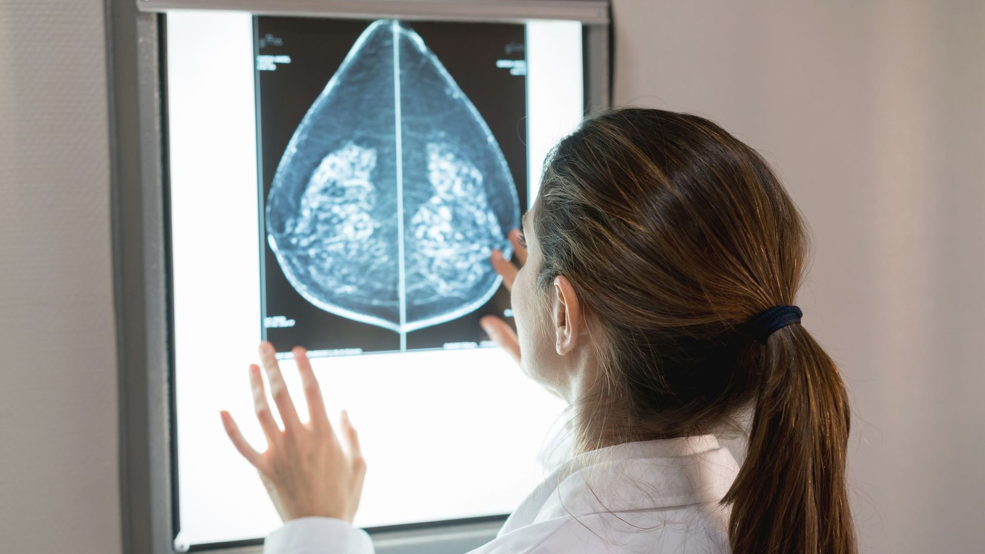 Cancer du sein: combinée à un traitement ciblé, l'hormonothérapie augmenterait les chances de survie des patientes.