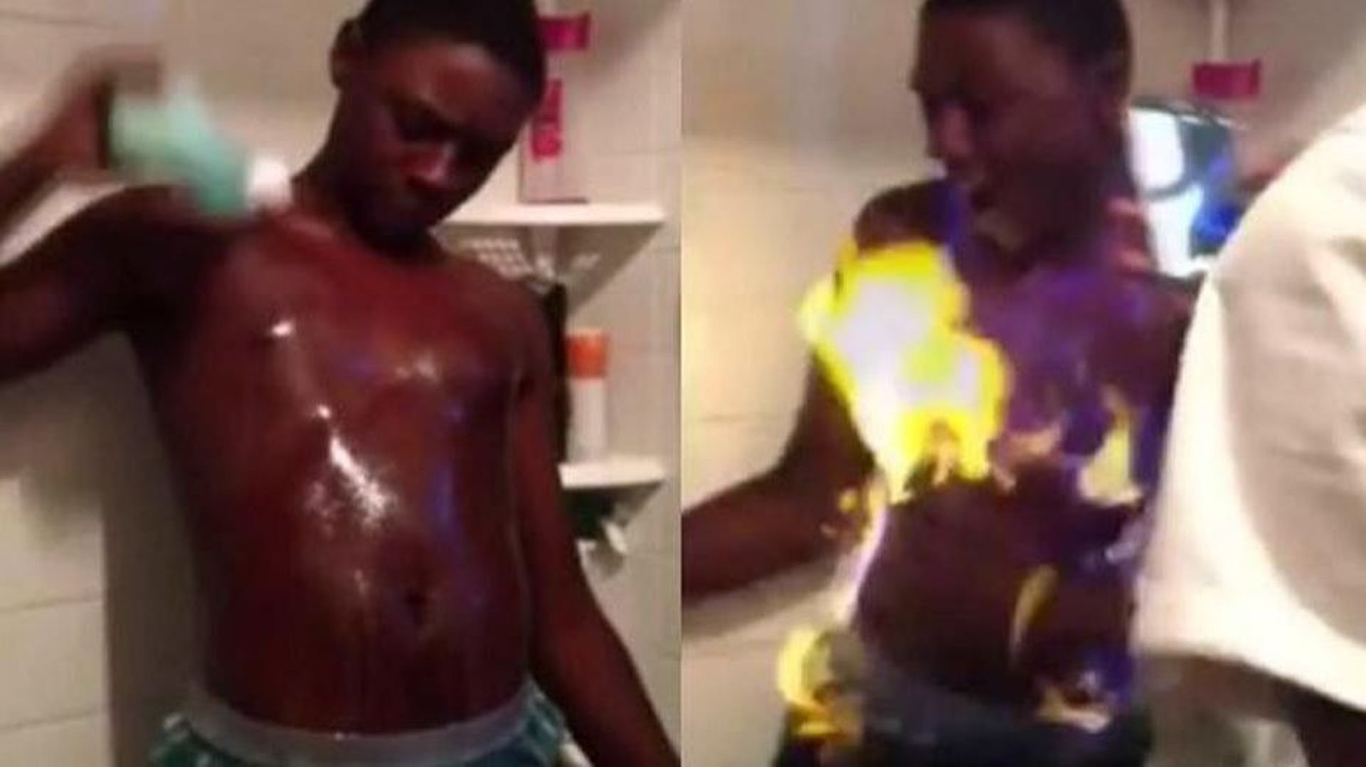 Le #FireChallenge consiste à s'arroser le corps d'alcool puis d'y mettre le feu
