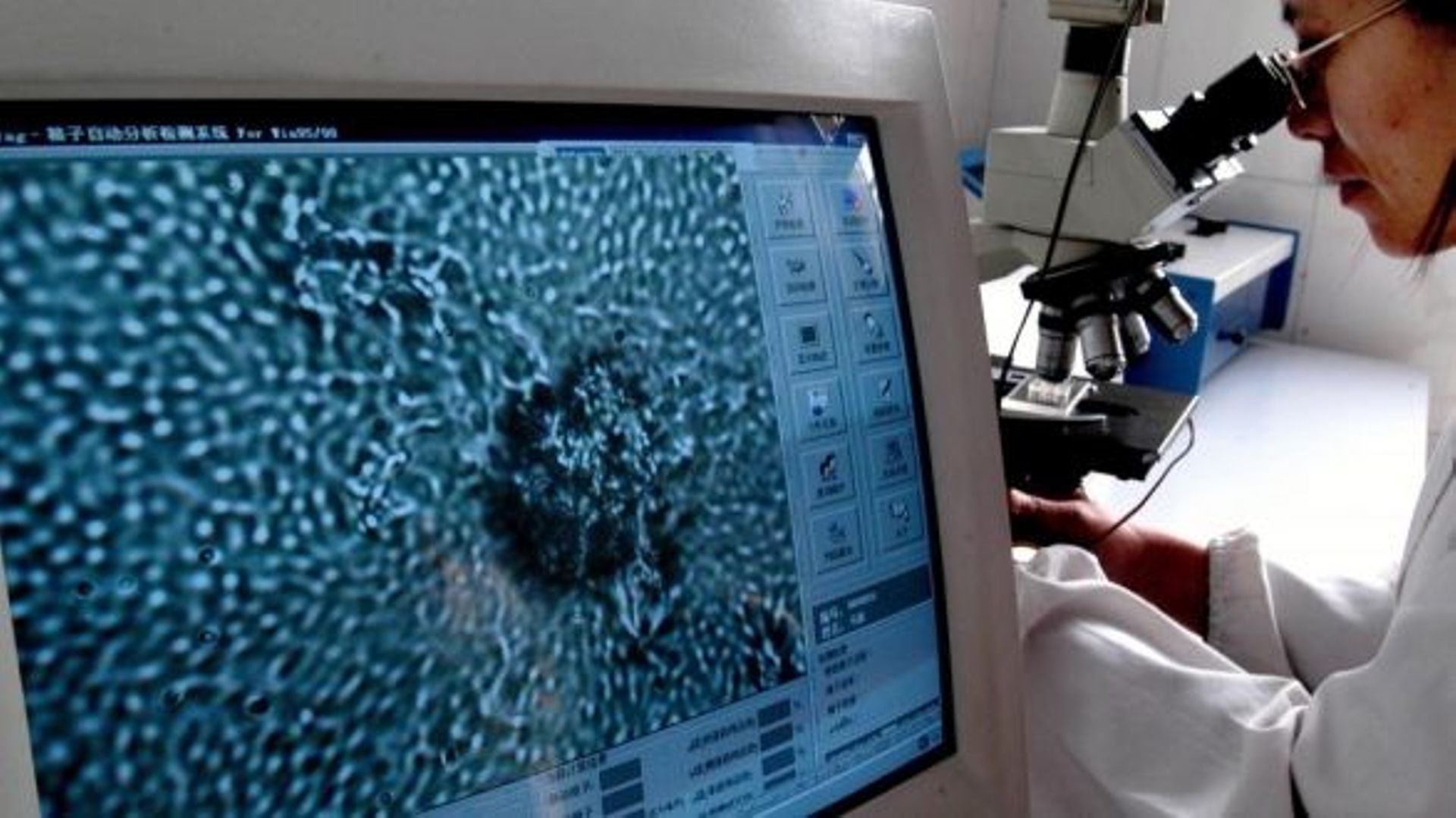 Un test belge permettrait de dépister le cancer de la prostate - RTBF Actus