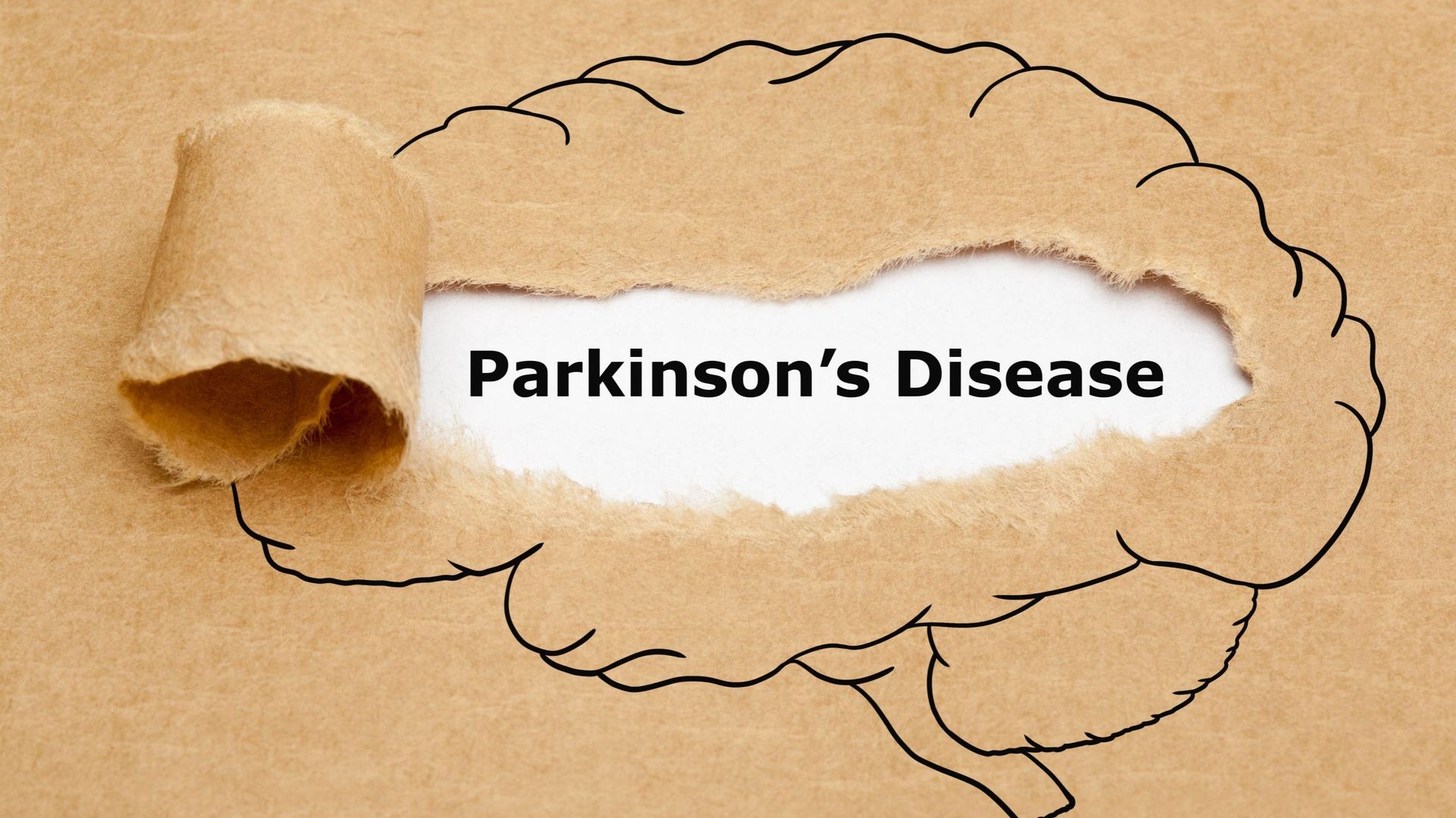 Maladie de Parkinson : une équipe de l’UCLouvain découvre la mécanique de précision derrière certaines formes génétiques