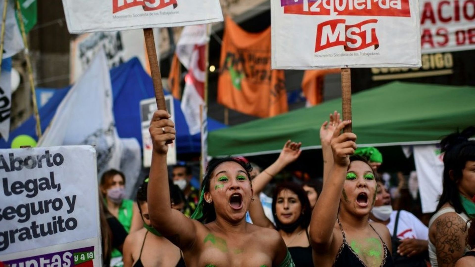 argentine-un-an-apres-la-legalisation-de-l-avortement-les-pratiques-evoluent-lentement