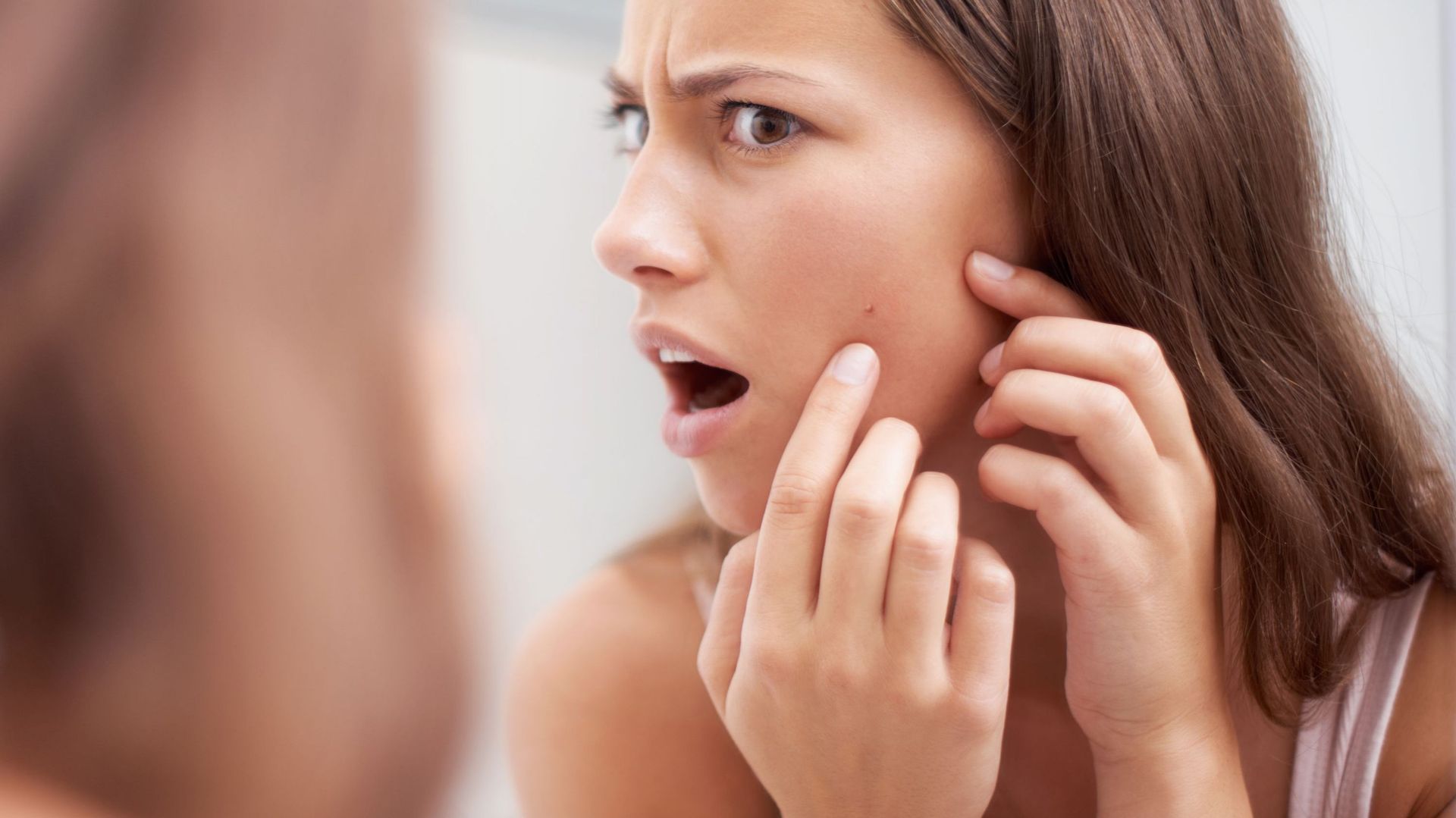 Comment en finir avec votre acné ?