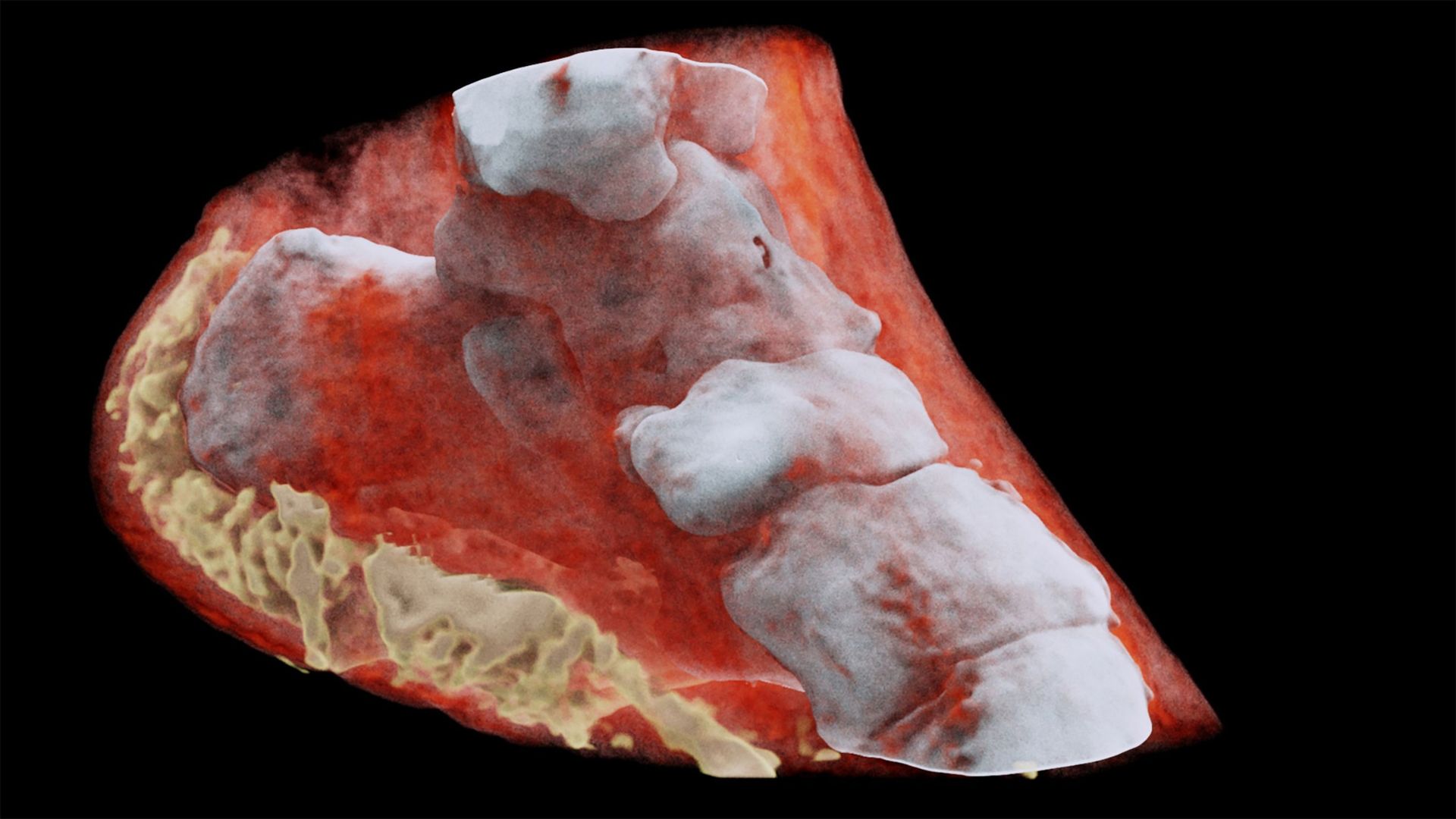 Selon le CERN, les images montrent très clairement la différence entre l'os, le muscle et le cartilage, mais aussi la position et la taille des tumeurs cancéreuses, par exemple.