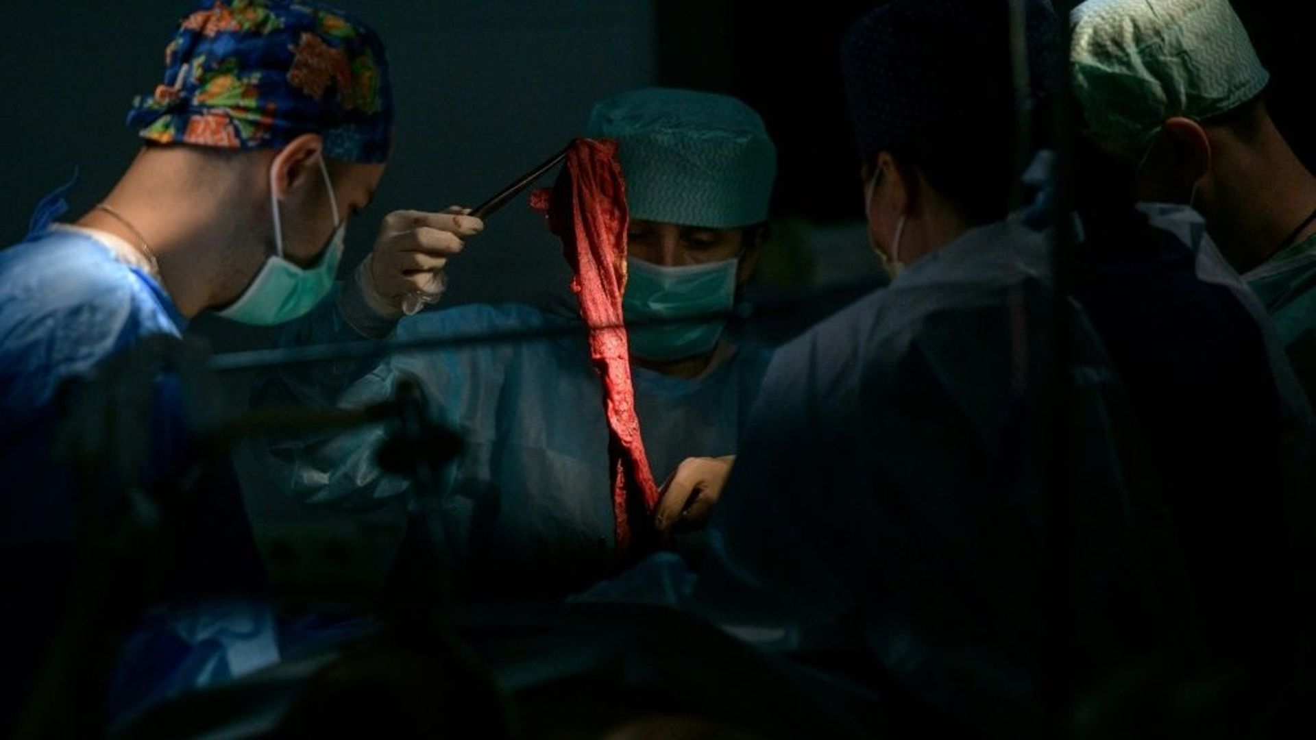 Des chirurgiens opèrent un soldat ukrainien blessé à l’hôpital militaire de Zaporijjia, le 18 avril 2022