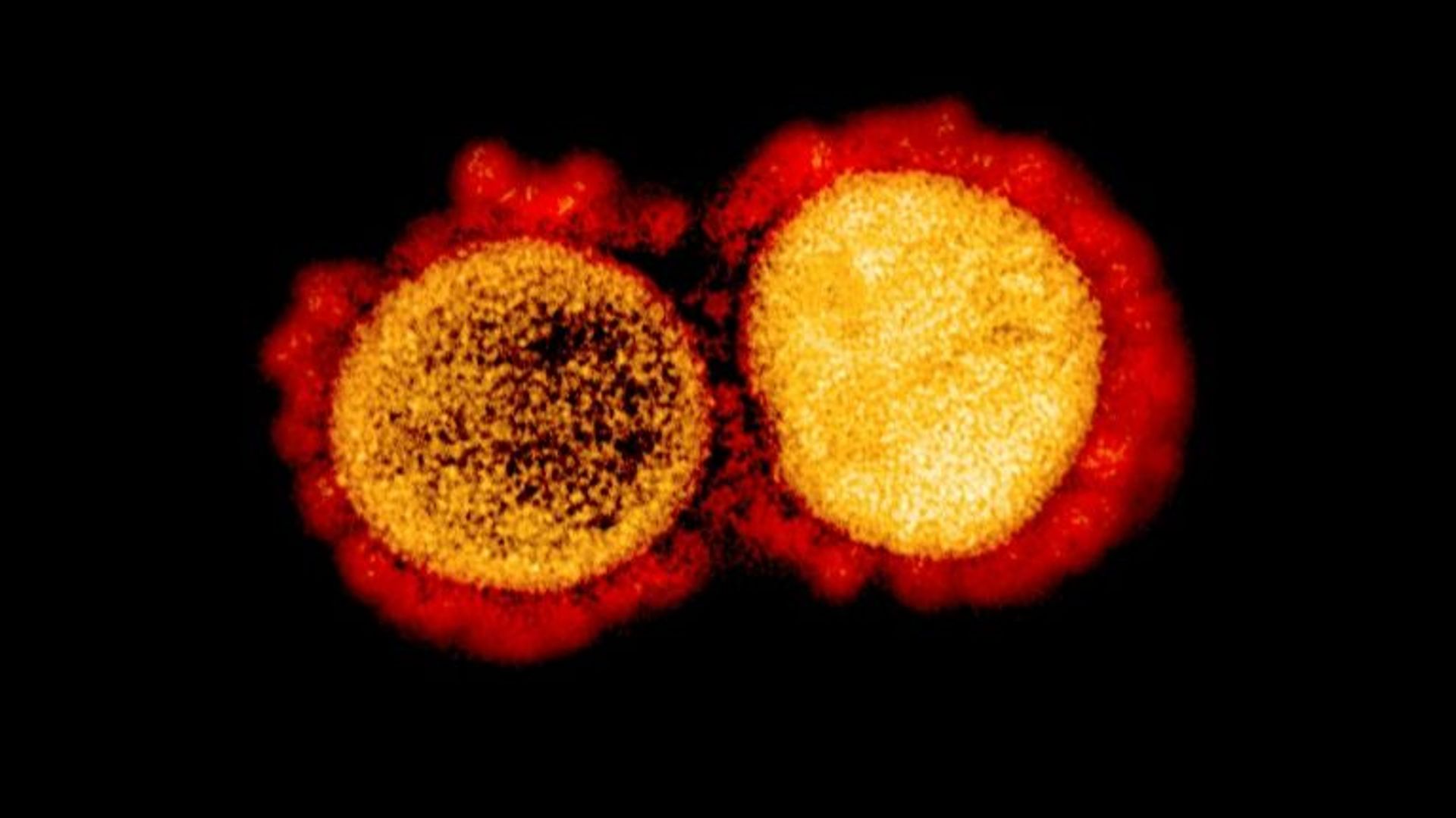 Une image du virus SARS-CoV-2 transmise par les Instituts nationaux de santé (NIH/NIAD) le 11 août 2020