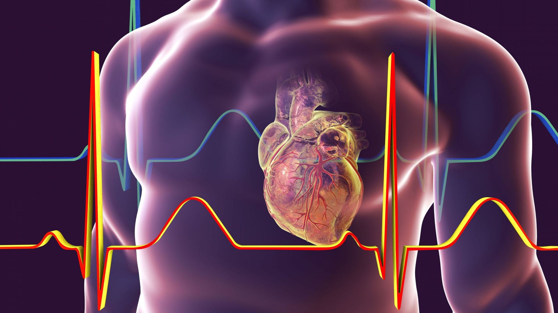 Différence entre crise cardiaque, arrêt cardiaque et insuffisance cardiaque ?