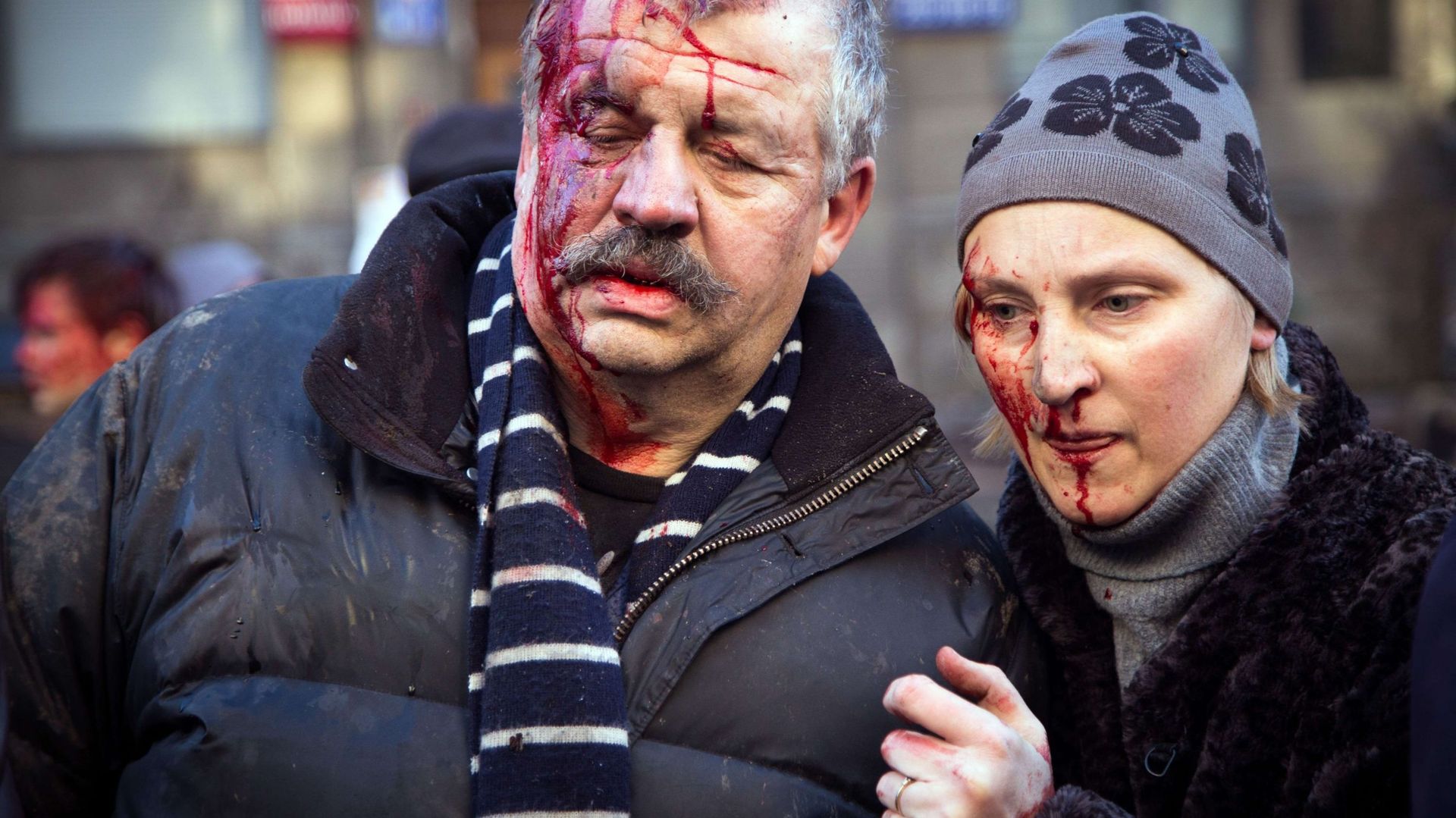 Des manifestants blessés après des affrontements avec les forces de l'ordre, à Kiev
