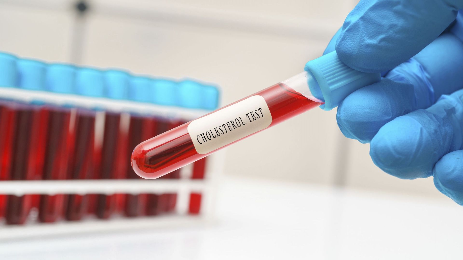 Cholesterol blood test, conceptual image