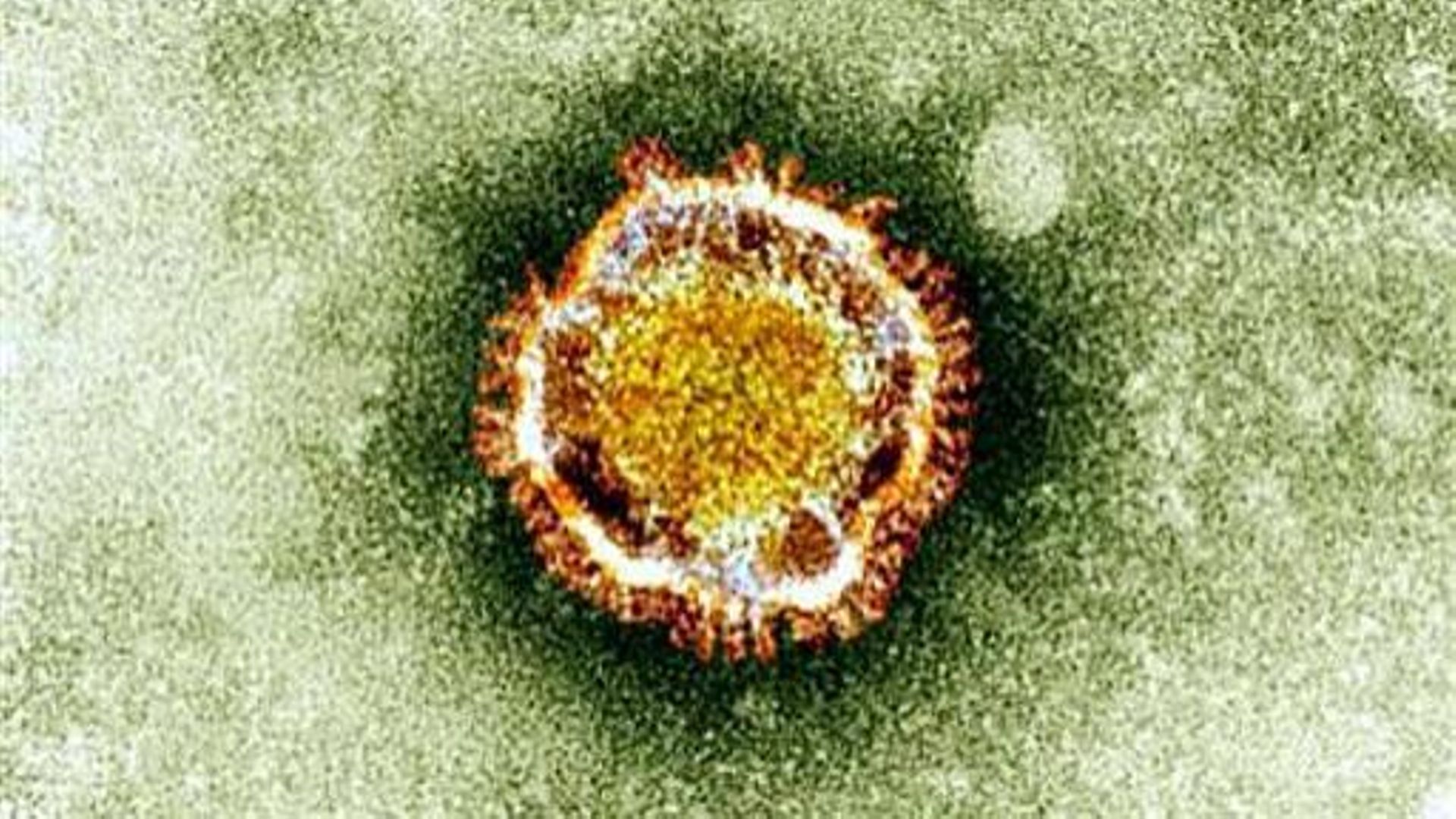 Photo non datée du nouveau coronavirus vu d'un microscope électronique