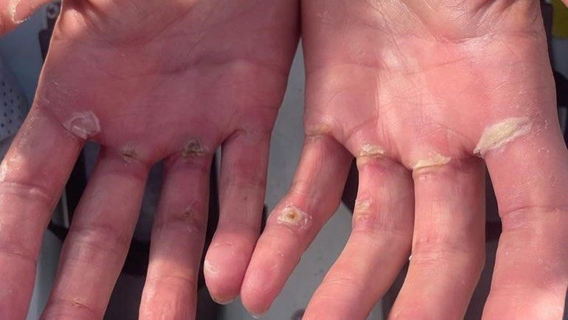 Les mains des Atlantic Endeavoar