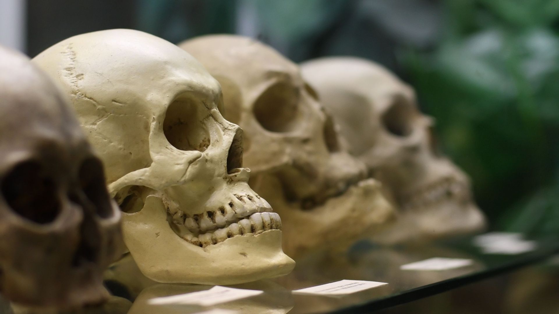 Passé colonial : la Suisse détient plus de 4000 ossements humains issus de colonies, révèle l’Université de Lausanne